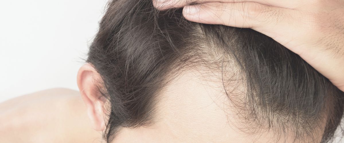What Men Should Know About Hair Thinning (And Why Most Products Get It Wrong)