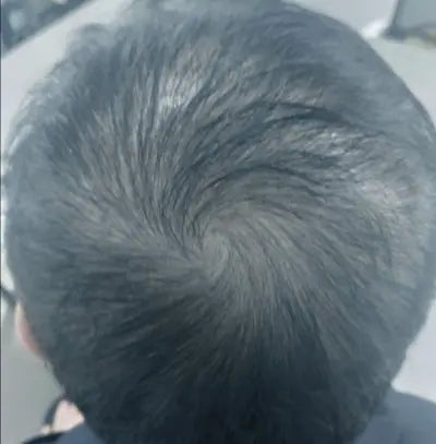 After 3 months