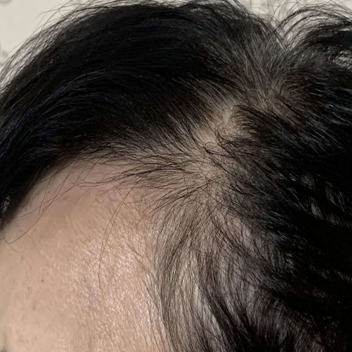 After 4 weeks