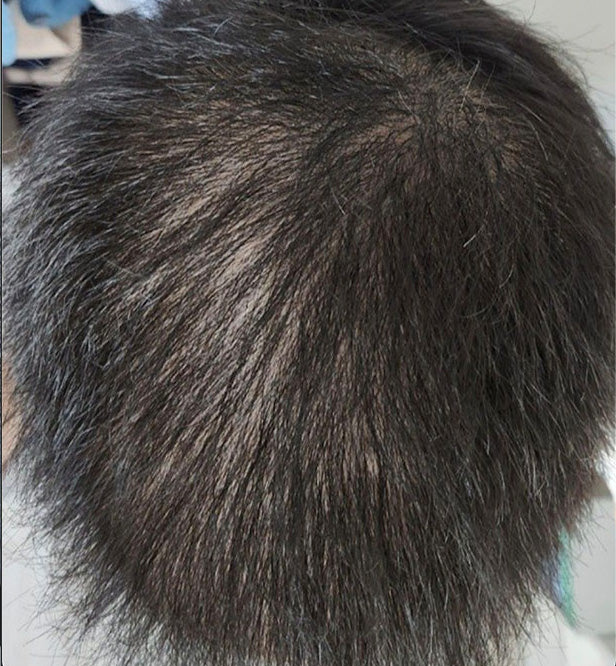 After 3 1/2 months