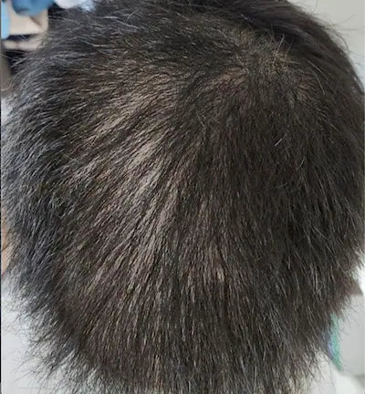 After 3 1/2 months